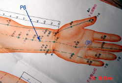 acupuncture acupressure Pericardium points P6